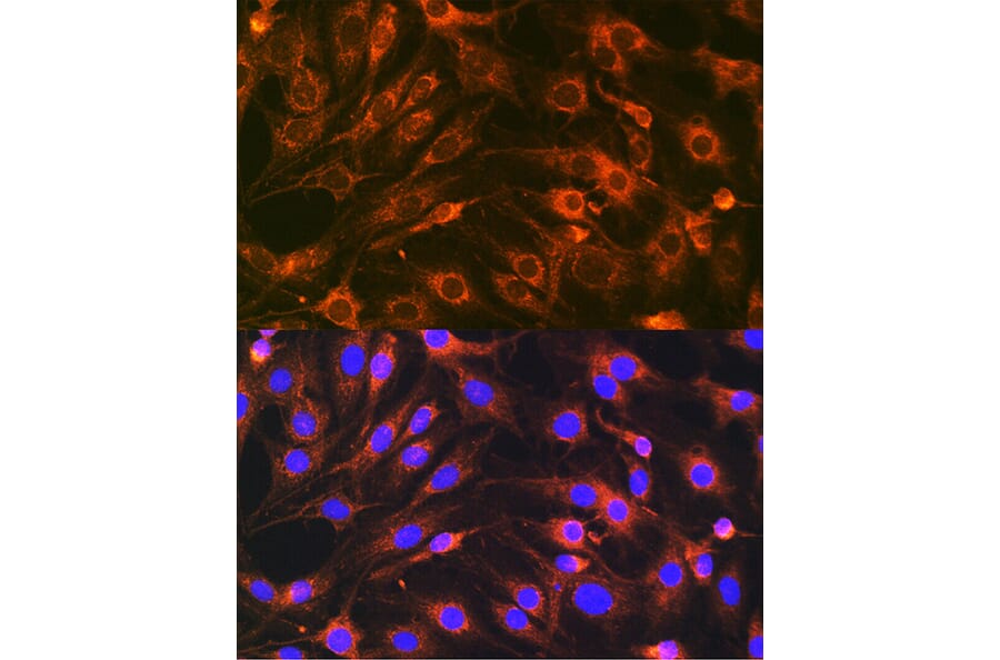 Immunofluorescence - Anti-SYBL1/VAMP-7 Antibody (A306141) - Antibodies.com
