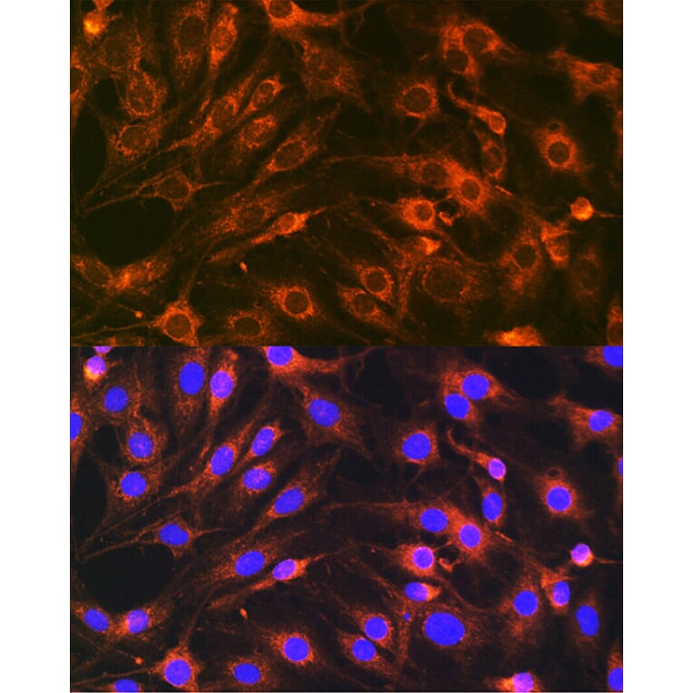 Immunofluorescence - Anti-SYBL1/VAMP-7 Antibody (A306141) - Antibodies.com