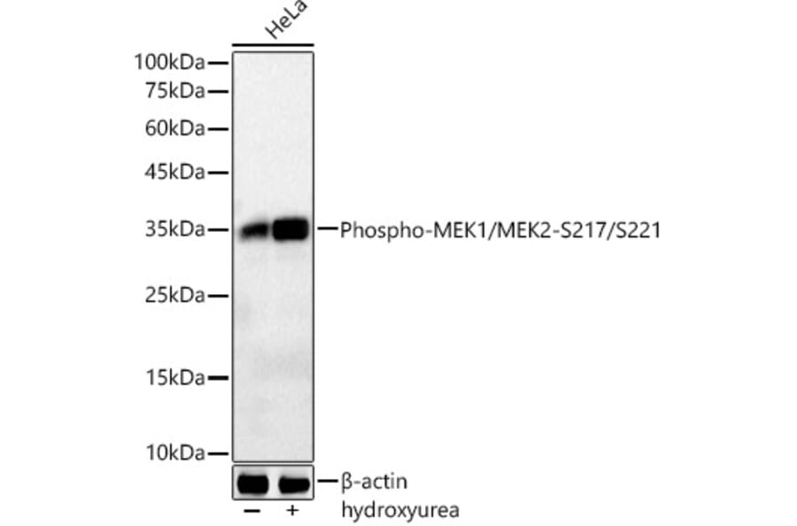 Western Blot - Anti-CDK1 (phospho Tyr15) Antibody [ARC55443] (A306142) - Antibodies.com