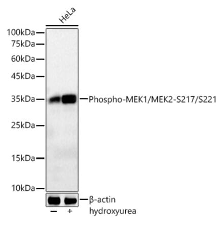 Western Blot - Anti-CDK1 (phospho Tyr15) Antibody [ARC55443] (A306142) - Antibodies.com