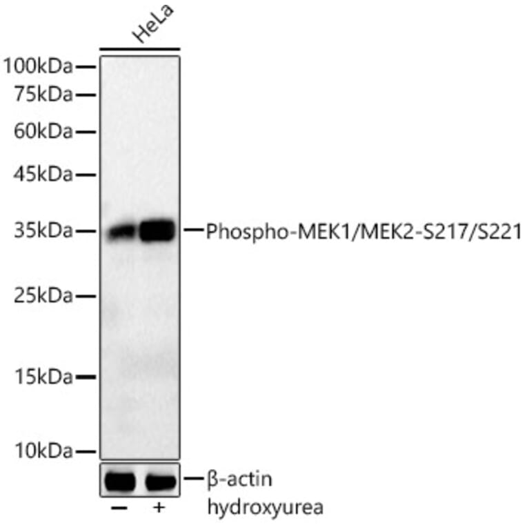 Western Blot - Anti-CDK1 (phospho Tyr15) Antibody [ARC55443] (A306142) - Antibodies.com