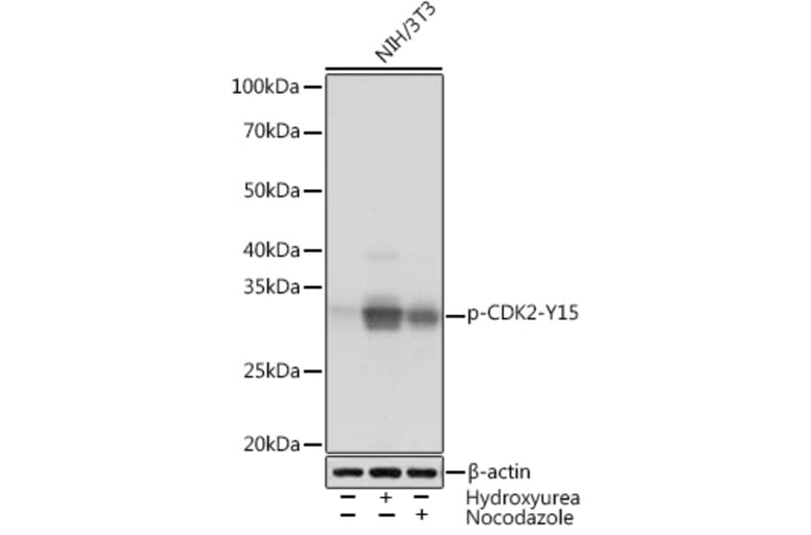 Western Blot - Anti-CDK2 (phospho Tyr15) Antibody [ARC1550] (A306143) - Antibodies.com