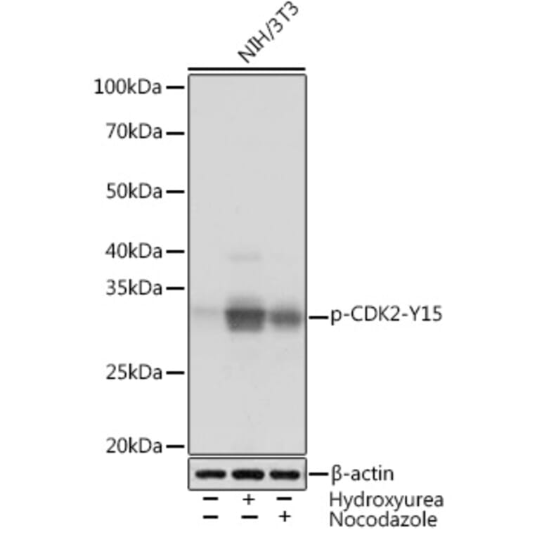 Western Blot - Anti-CDK2 (phospho Tyr15) Antibody [ARC1550] (A306143) - Antibodies.com