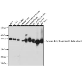 Western Blot - Anti-PDHB Antibody [ARC1074] (A306144) - Antibodies.com