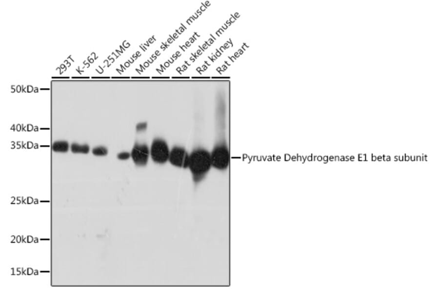 Western Blot - Anti-PDHB Antibody [ARC1074] (A306144) - Antibodies.com