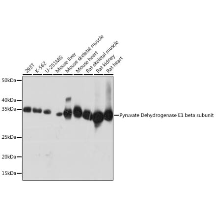 Western Blot - Anti-PDHB Antibody [ARC1074] (A306144) - Antibodies.com