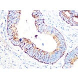 Immunohistochemistry - Anti-PDHB Antibody [ARC1074] (A306144) - Antibodies.com