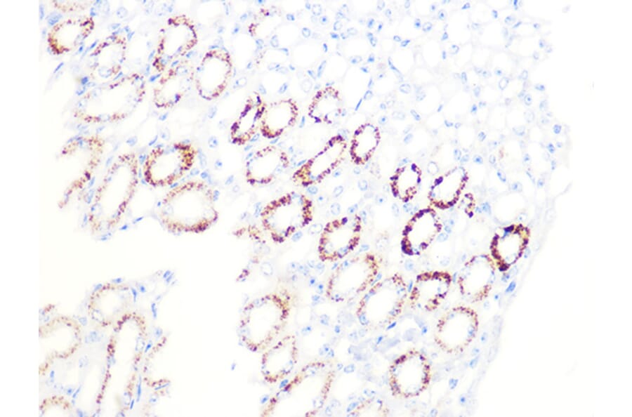 Immunohistochemistry - Anti-PDHB Antibody [ARC1074] (A306144) - Antibodies.com