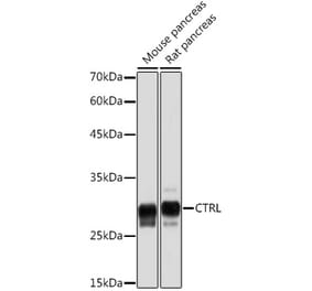 Western Blot - Anti-CTRL Antibody (A306145) - Antibodies.com