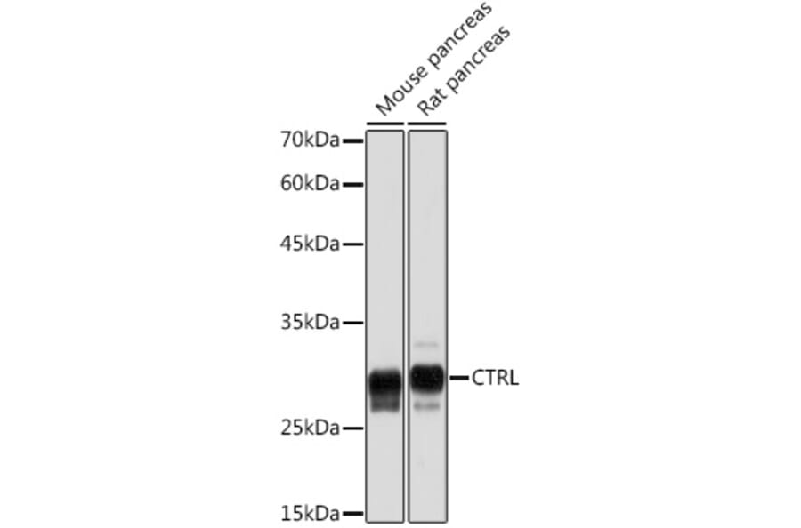 Western Blot - Anti-CTRL Antibody [ARC2218] (A306145) - Antibodies.com