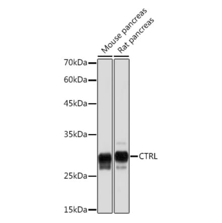 Western Blot - Anti-CTRL Antibody [ARC2218] (A306145) - Antibodies.com