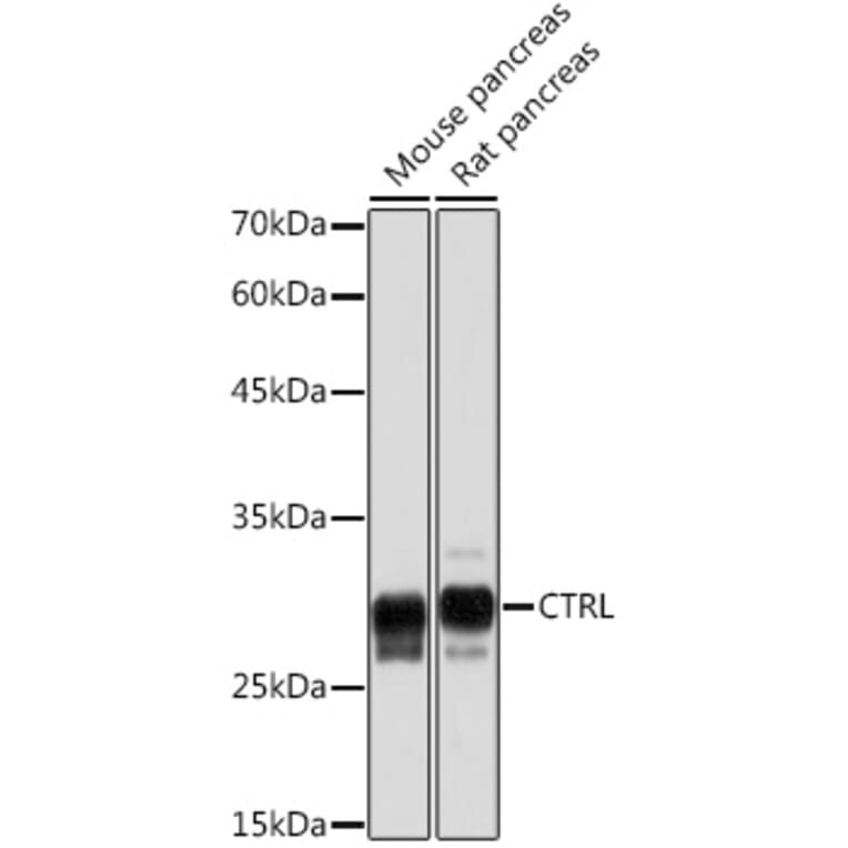 Western Blot - Anti-CTRL Antibody [ARC2218] (A306145) - Antibodies.com