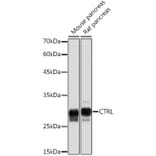 Western Blot - Anti-CTRL Antibody [ARC2218] (A306145) - Antibodies.com