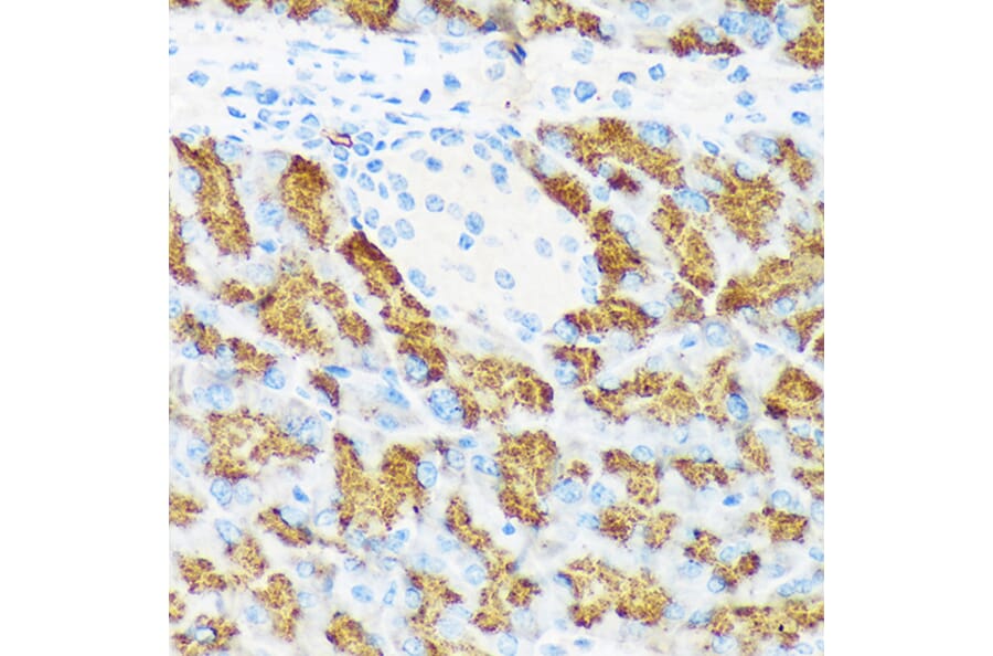 Immunohistochemistry - Anti-CTRL Antibody [ARC2218] (A306145) - Antibodies.com