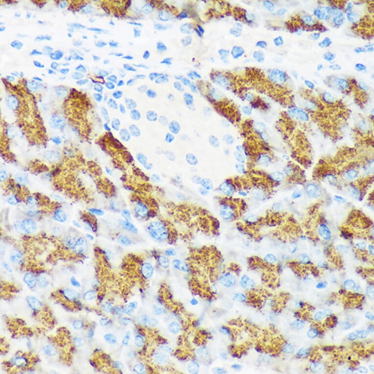 Immunohistochemistry - Anti-CTRL Antibody [ARC2218] (A306145) - Antibodies.com