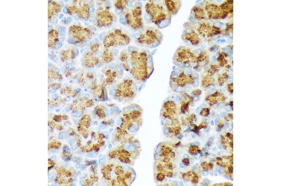 Immunohistochemistry - Anti-CTRL Antibody [ARC2218] (A306145) - Antibodies.com