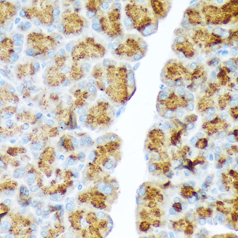 Immunohistochemistry - Anti-CTRL Antibody [ARC2218] (A306145) - Antibodies.com