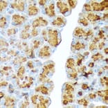 Immunohistochemistry - Anti-CTRL Antibody [ARC2218] (A306145) - Antibodies.com