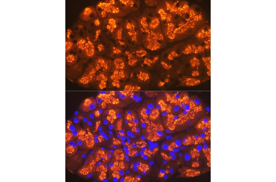 Immunofluorescence - Anti-CTRL Antibody [ARC2218] (A306145) - Antibodies.com