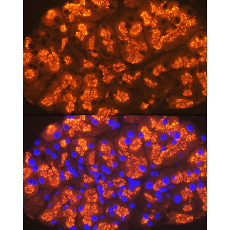Immunofluorescence - Anti-CTRL Antibody [ARC2218] (A306145) - Antibodies.com