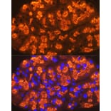 Immunofluorescence - Anti-CTRL Antibody [ARC2218] (A306145) - Antibodies.com