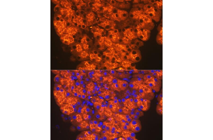 Immunofluorescence - Anti-CTRL Antibody [ARC2218] (A306145) - Antibodies.com