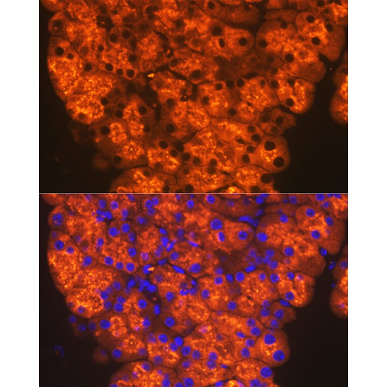 Immunofluorescence - Anti-CTRL Antibody [ARC2218] (A306145) - Antibodies.com