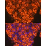 Immunofluorescence - Anti-CTRL Antibody [ARC2218] (A306145) - Antibodies.com
