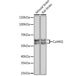 Western Blot - Anti-CaMKII beta Antibody [ARC1814] (A306146) - Antibodies.com