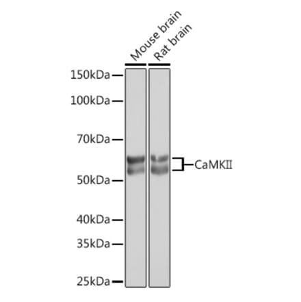 Western Blot - Anti-CaMKII beta Antibody [ARC1814] (A306146) - Antibodies.com