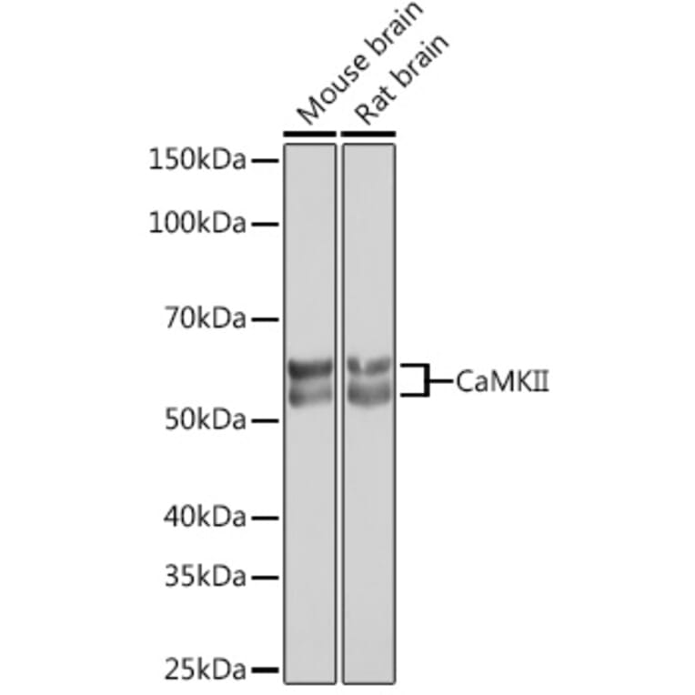 Western Blot - Anti-CaMKII beta Antibody [ARC1814] (A306146) - Antibodies.com