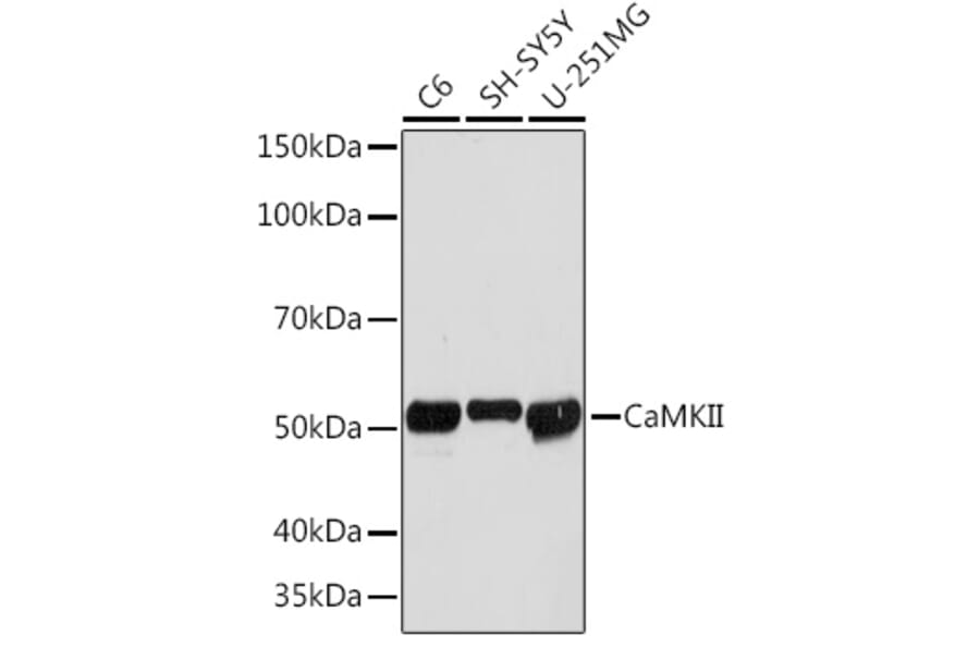 Western Blot - Anti-CaMKII beta Antibody [ARC1814] (A306146) - Antibodies.com