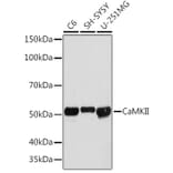 Western Blot - Anti-CaMKII beta Antibody [ARC1814] (A306146) - Antibodies.com