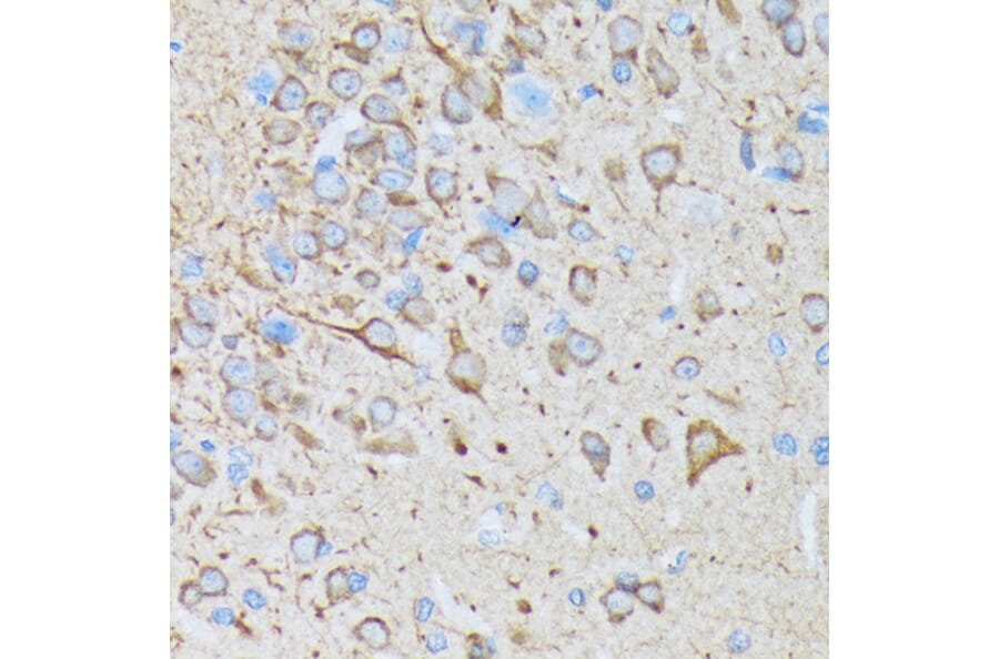 Immunohistochemistry - Anti-CaMKII beta Antibody [ARC1814] (A306146) - Antibodies.com