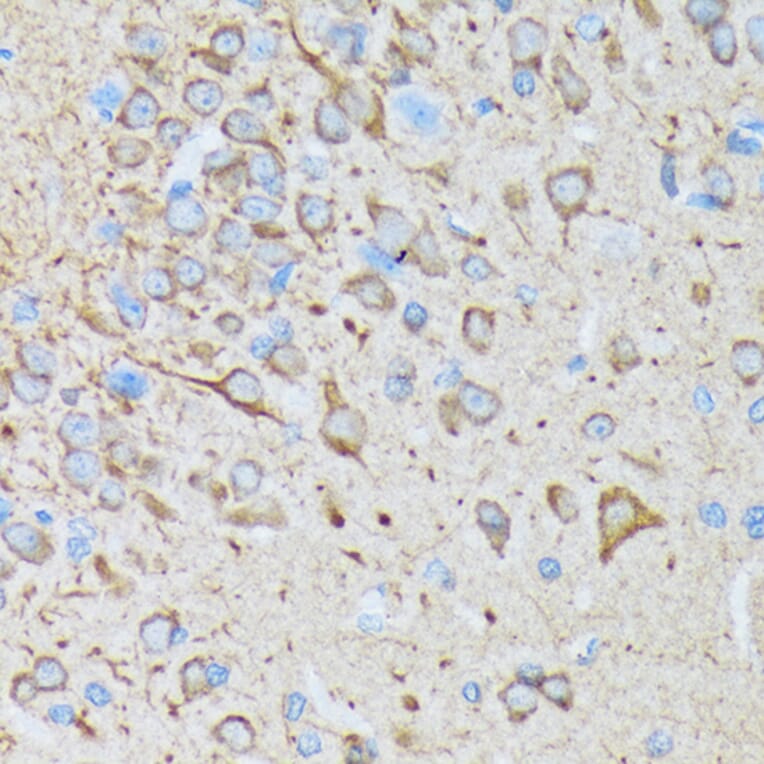 Immunohistochemistry - Anti-CaMKII beta Antibody [ARC1814] (A306146) - Antibodies.com