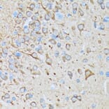 Immunohistochemistry - Anti-CaMKII beta Antibody [ARC1814] (A306146) - Antibodies.com