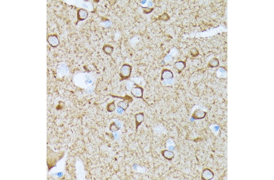 Immunohistochemistry - Anti-CaMKII beta Antibody [ARC1814] (A306146) - Antibodies.com