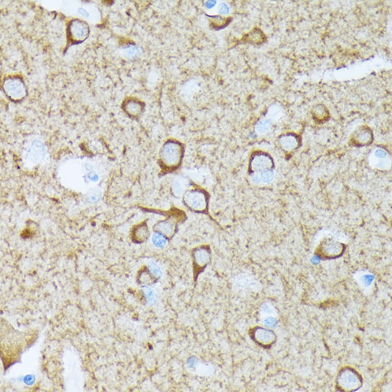 Immunohistochemistry - Anti-CaMKII beta Antibody [ARC1814] (A306146) - Antibodies.com