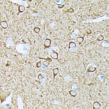 Immunohistochemistry - Anti-CaMKII beta Antibody [ARC1814] (A306146) - Antibodies.com