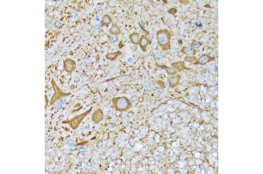 Immunohistochemistry - Anti-CaMKII beta Antibody [ARC1814] (A306146) - Antibodies.com