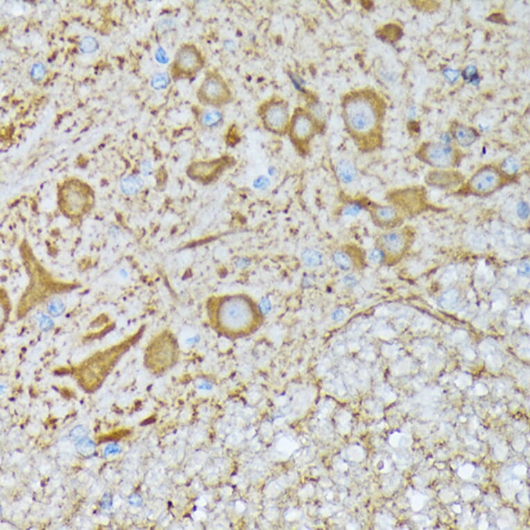 Immunohistochemistry - Anti-CaMKII beta Antibody [ARC1814] (A306146) - Antibodies.com