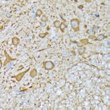 Immunohistochemistry - Anti-CaMKII beta Antibody [ARC1814] (A306146) - Antibodies.com