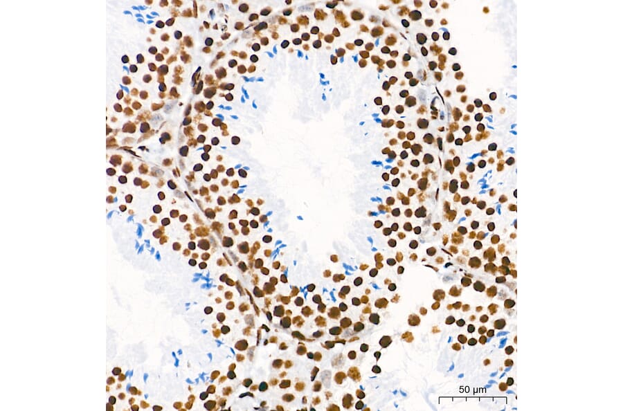 Chromatin Immunoprecipitation - Anti-Histone H3 (tri methyl Lys36) Antibody (A306148) - Antibodies.com
