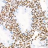 Chromatin Immunoprecipitation - Anti-Histone H3 (tri methyl Lys36) Antibody (A306148) - Antibodies.com