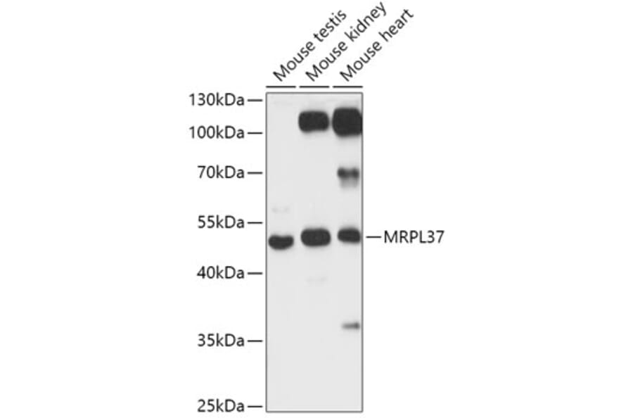 Western Blot - Anti-MRPL37 Antibody (A306149) - Antibodies.com