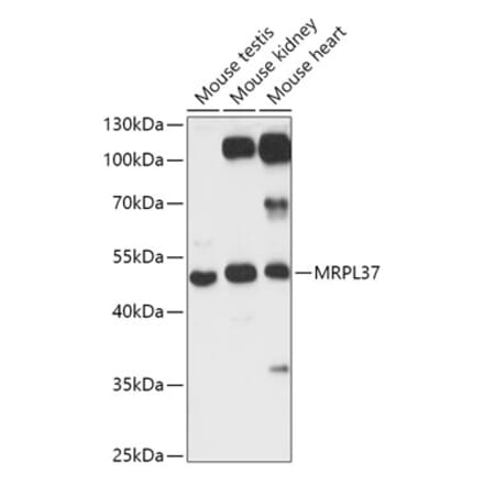 Western Blot - Anti-MRPL37 Antibody (A306149) - Antibodies.com