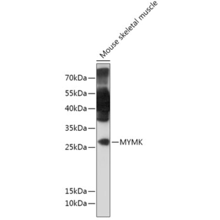 Western Blot - Anti-TMEM8C Antibody (A306150) - Antibodies.com
