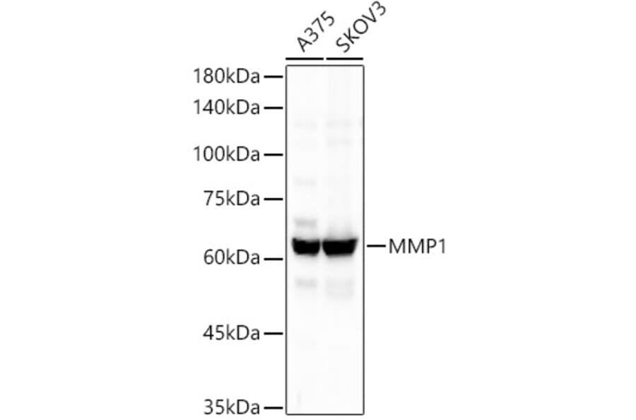 Western Blot - Anti-MMP1 Antibody [ARC55239] (A306151) - Antibodies.com