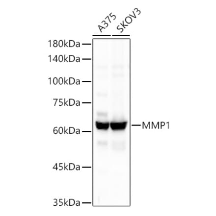 Western Blot - Anti-MMP1 Antibody [ARC55239] (A306151) - Antibodies.com