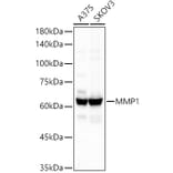 Western Blot - Anti-MMP1 Antibody [ARC55239] (A306151) - Antibodies.com